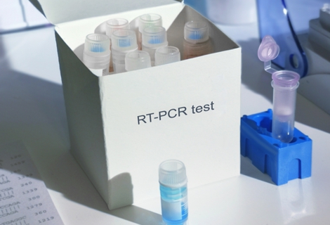 Novel coronavirus 2019 nCoV pcr diagnostics kit. This is RT-PCR kit to detect presence of 2019-nCoV or covid19 virus in patient samples. In vitro diagnostic test based on real-time PCR technology