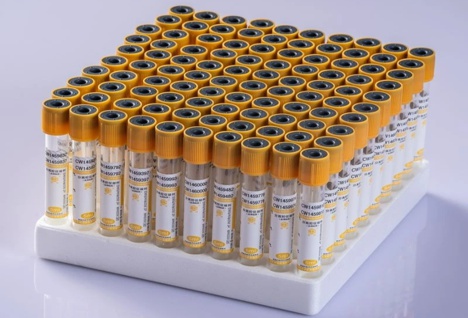 001_ut.com.pe_tubo-activador-de-gel-y-coágulos_jun-nuo