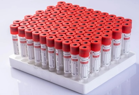 004_ut.com.pe_tubo-activador-de-coágulos-al-vacío-tapa roja_jun-nuo